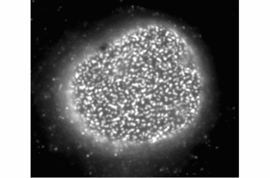 Immunofluorescent staining of rat neuron with antibody R4C8. The dots are Nup153.