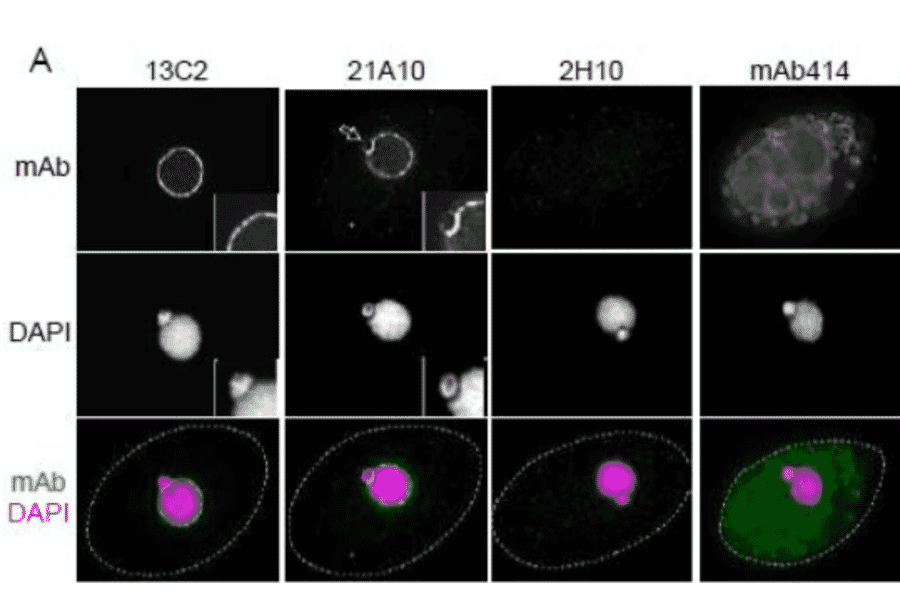 Immunofluorescene staining of Nup98 in Tetrahymena themophila cells using 13C2 , 21A10 , 2H10 or 414 monoclonal antibodies