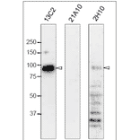 Western blot analysis of Nup98 in HeLa cells with anti-Nup98 antibodies.