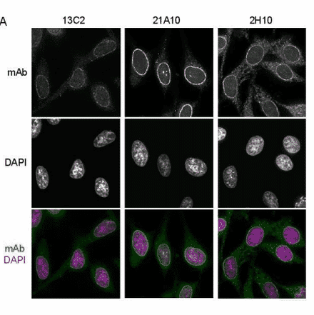 Immunofluorescene staining of Nup98 in HeLa cells using 13C2 , 21A10 , or 2H10 monoclonal antibodies.