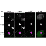 Immunofluorescene staining of Nup98 in Tetrahymena themophila cells using 13C2 , 21A10 , 2H10 or 414 monoclonal antibodies