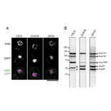 Monoclonal antibodies 13C2 and 21A10 crossreact with multiple nucleoporins of S. cerevisiae. (A) IF staining of S. cereviciae cells using 13C2, 21A10, or 2H10 mAbs: 1/10 dilutions of the supernatants of hybridoma cultures of 13C2 or 21A10 or 10 µg/ml IgG solution of 2H10 were used. Black-and-white images represent fluorescence images obtained with mAb (top) and DAPI (middle). Color images represent merged images of mAb (green) with DAPI (magenta). Dotted lines represent the outlines of cells. Bar, 5 µm. Methods were as described for S. pombe. (B) WB analysis of S. cereviciae cell extract using 13C2 , 21A10, or 2H10 mAbs: 1/10 dilutions of the supernatants of hybridoma culture medium of 13C2 or 21A10 or 2 µg/ml IgG solution of 2H10 were used. Arrows represent the positions of the indicated nucleoporins. Asterisks represent uncharacterized proteins. Methods were as described for S. pombe