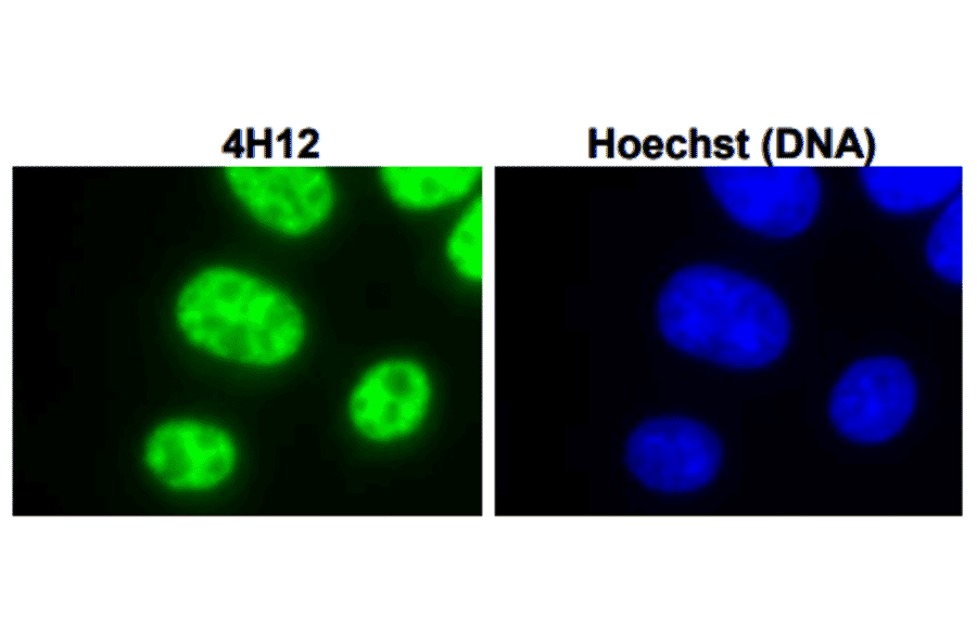 Immunofluorescent staining of L929 (mouse) cells with anti-UIC antibody (4H12).
