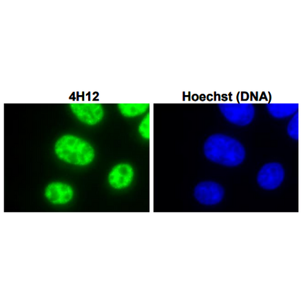 Immunofluorescent staining of L929 (mouse) cells with anti-UIC antibody (4H12).