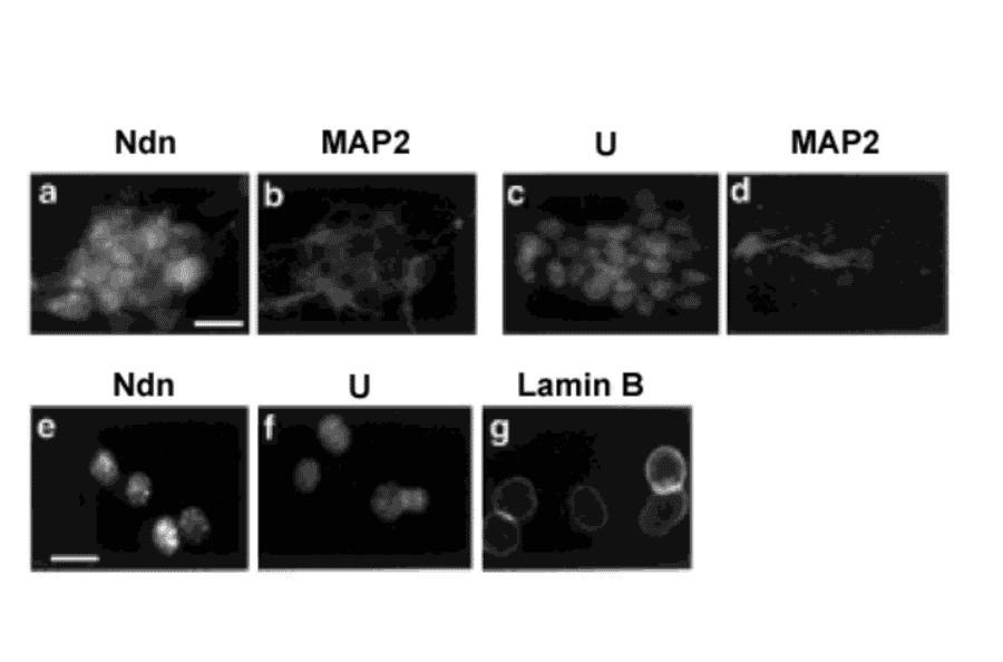 Immunocytochemistry using this antibody, HUT (ref.2) Mouse P19 neurons were labeled with anti-necdin antibody (Ndn) (a) or with HUT for hnRNP-U (U) (c) in combination with anti-neuronal marker, MAP2, antibody for MAP2 (b, d). The nuclear matrix was prepared in situ and labeled for necdin (Ndn) (e), hnRNP-U (U) (f), and a nuclear matrix marker, lamin B (g). Both necdin and hnRNP-U were localized to the nuclei of differentiated neurons, which express the neuronal marker MAP2 (a-d). Necdin was also distributed in the neuronal cytoplasm (a). The immunocytochemical analysis of in situ extracted nuclear matrix revealed that both necdin and hnRNP-U were concentrated in intranuclear speckles throughout the nucleoplasm (e, f). Lamin B, a nuclear matrix marker, was localized to the nuclear lamina (g). These results suggest that both necdin and hnRNP-U are associated with the nuclear matrix of neurons