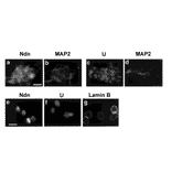 Immunocytochemistry using this antibody, HUT (ref.2) Mouse P19 neurons were labeled with anti-necdin antibody (Ndn) (a) or with HUT for hnRNP-U (U) (c) in combination with anti-neuronal marker, MAP2, antibody for MAP2 (b, d). The nuclear matrix was prepared in situ and labeled for necdin (Ndn) (e), hnRNP-U (U) (f), and a nuclear matrix marker, lamin B (g). Both necdin and hnRNP-U were localized to the nuclei of differentiated neurons, which express the neuronal marker MAP2 (a-d). Necdin was also distributed in the neuronal cytoplasm (a). The immunocytochemical analysis of in situ extracted nuclear matrix revealed that both necdin and hnRNP-U were concentrated in intranuclear speckles throughout the nucleoplasm (e, f). Lamin B, a nuclear matrix marker, was localized to the nuclear lamina (g). These results suggest that both necdin and hnRNP-U are associated with the nuclear matrix of neurons