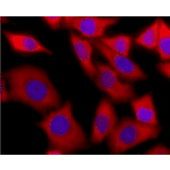 Immunostaining of Hela cells with anti-DDX3X antibody. Hela cells were stained with anti-DDX3X antibody (red) at 1/500 dilution and as the secondary antibody, Alexa Fluor 568-conjugated goat anti-rabbit antibody at 2 µg/ml. The nuclei were stained with Hoechst (blue)