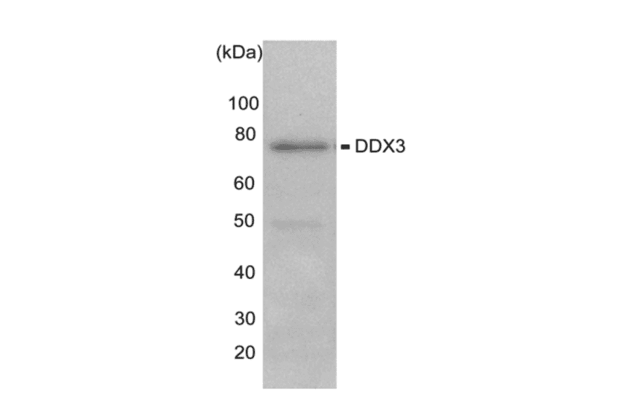 Immunohistochemiocal staining of DDX3X in mouse testis tissue. Frozen section was stained with anti-DDX3X antibody at 1/200 dilution and secondarily labeled with Cys-conjugated anti-rabbit IgG. Arrows indicate Leydig cells.