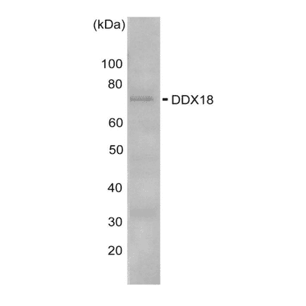Western blot analysis of DDX3 in the whole cell extracts of HeLa cells (10?g) with anti -DDX18 antibody at 1,000 fold dilution