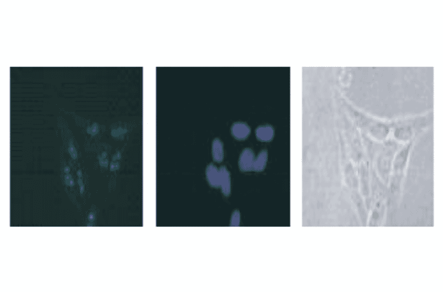 Immunostaining of DDX18 in HeLa cells with anti DDX18 antibody followed by FITC-conjugated anti-rabbit IgG second antibody.DNA was stained with Hoechst dye