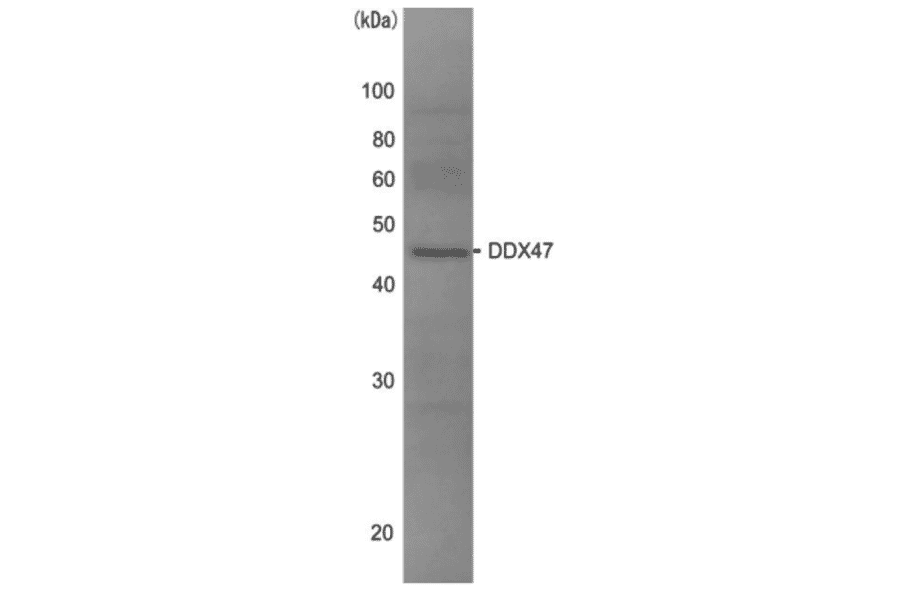 Western blot analysis of DDX47 in the whole cell extracts of HeLa cells (10?g) with anti-DDX47 antibody at 1/1,000 dilution