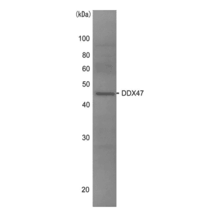 Western blot analysis of DDX47 in the whole cell extracts of HeLa cells (10?g) with anti-DDX47 antibody at 1/1,000 dilution