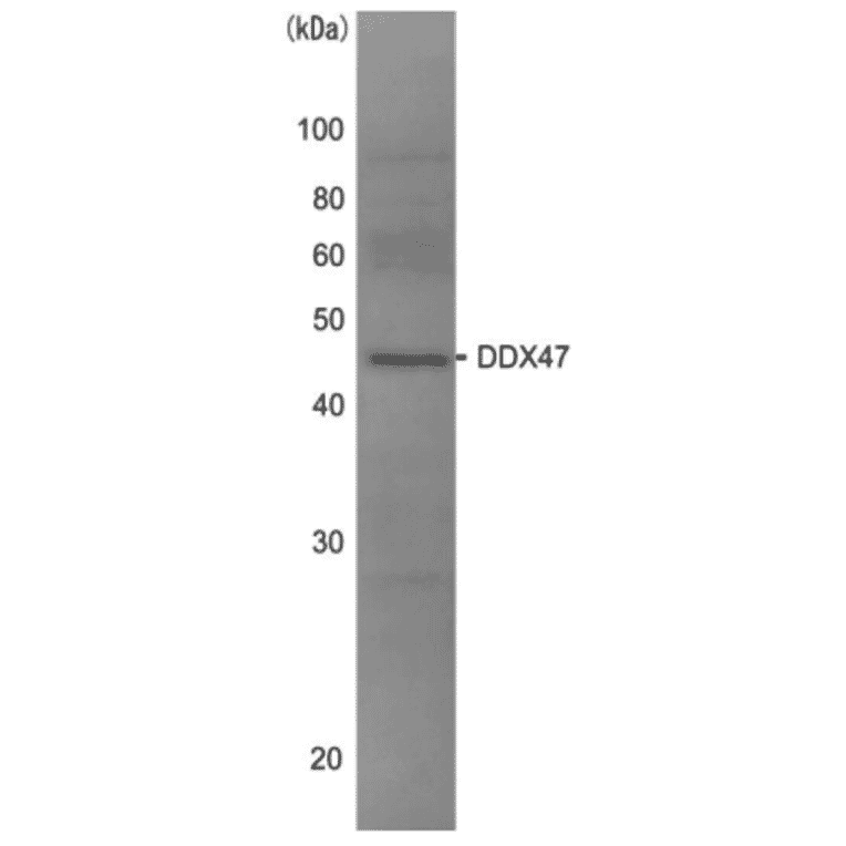 Western blot analysis of DDX47 in the whole cell extracts of HeLa cells (10?g) with anti-DDX47 antibody at 1/1,000 dilution