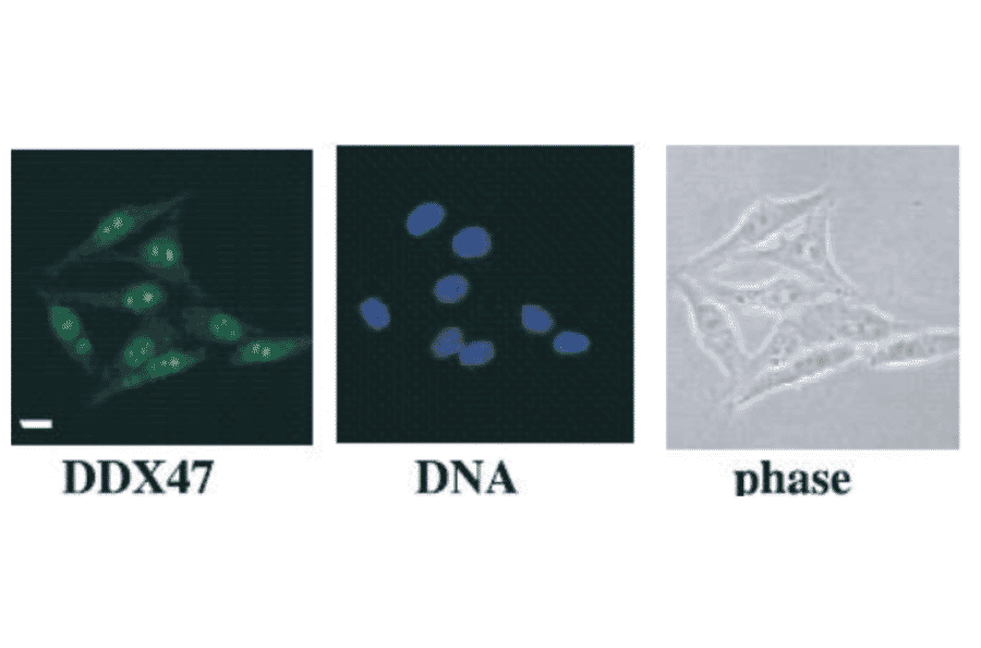 HeLa cells were fixed and immunostained with anti-DDX47 antibody followed by FITC-conjugated anti-rabbit IgG secondary antibody. DNA was stained with Hoechst dye.