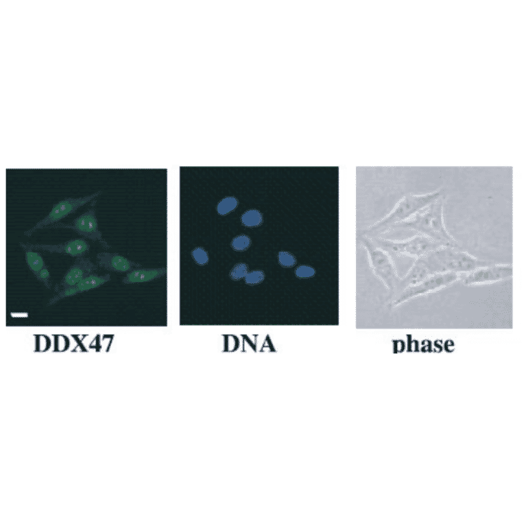 HeLa cells were fixed and immunostained with anti-DDX47 antibody followed by FITC-conjugated anti-rabbit IgG secondary antibody. DNA was stained with Hoechst dye.