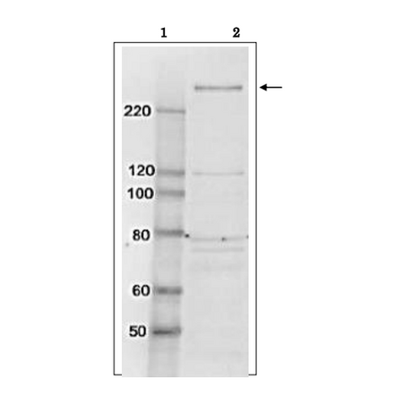 Identification of TAF1 protein in whole cell extract of HeLa cells by western blotting using anti-TAF1 antibody. Lane 1; Size marker proteins (kDa) Lane 2; HeLa cell whole extract (10 µg) Arrow indicates the position of TAF1 protein band