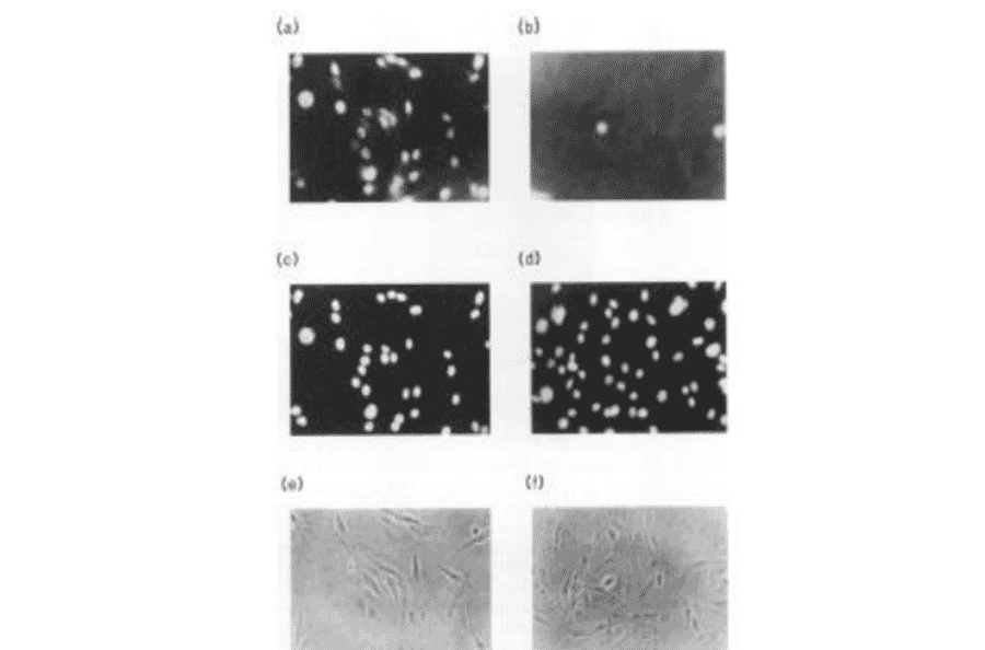 Immunofluorescence staining of TAF1 protein in BHK cells with anti-TAF1 antibody. (a) Reacted with anti-TAF1 antibody (b) Reacted with anti-TAF1 antibody in the presence of the immunogen peptide. (c) The same field as (a), stained with Hoechst 33258. (d) The same field as (b), stained with Hoechst 33258. (e) The same field as (a) and (c), photographed through phase-contrast microscope (f) The same field as (b) and (d), photographed through phase-contrast microscope. Growing cells were fixed with 3% formaldehyde and permiabilized 1% Nonidet P-40. As the 2nd antibody, goat anti-rabbit IgG conjugated with rhodamine was used. TAF1 protein was detected in nucleus.
