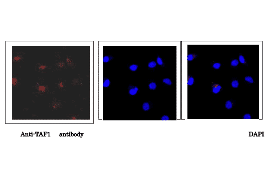 Immunofluorescence staining of TAF1 protein in HeLa cells with anti-TAF1 antibody. Hela cells were fixed with 4% paraformaldehyde and permeabilized with 0.25% Triton X-100. Anti-TAF1 antibody was used at 1/5,000 dilution. As a 2nd antibody, goat anti-rabbit IgG conjugated with Alex 488 was used at 1/1,000 dilution. Nucliei were stained with DAPI. The merged image was shown in the right panel. TAF1 protein was detected in nucleus.