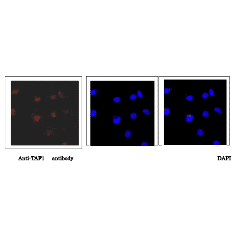 Immunofluorescence staining of TAF1 protein in HeLa cells with anti-TAF1 antibody. Hela cells were fixed with 4% paraformaldehyde and permeabilized with 0.25% Triton X-100. Anti-TAF1 antibody was used at 1/5,000 dilution. As a 2nd antibody, goat anti-rabbit IgG conjugated with Alex 488 was used at 1/1,000 dilution. Nucliei were stained with DAPI. The merged image was shown in the right panel. TAF1 protein was detected in nucleus.