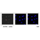 Immunofluorescence staining of TAF1 protein in HeLa cells with anti-TAF1 antibody. Hela cells were fixed with 4% paraformaldehyde and permeabilized with 0.25% Triton X-100. Anti-TAF1 antibody was used at 1/5,000 dilution. As a 2nd antibody, goat anti-rabbit IgG conjugated with Alex 488 was used at 1/1,000 dilution. Nucliei were stained with DAPI. The merged image was shown in the right panel. TAF1 protein was detected in nucleus.
