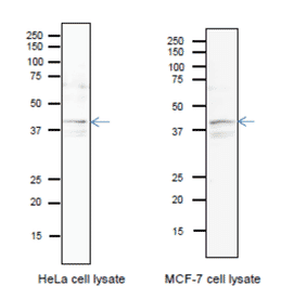 Identification of endogenous Pura protein in whole cell extracts of HeLa cells and MCF-7 cells. Arrow indicates the position of PURA bands The anti-Pura antibody was used at 1/1,000 dilution. 12.5% SDS-PAGE was used. Blotting was done in wet system at 15 v overnight. CanGetSignal (Toyobo, Osaka) was used as a signal enhancer