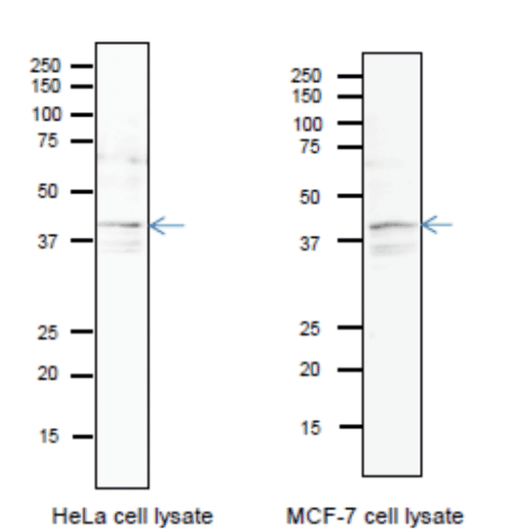 Identification of endogenous Pura protein in whole cell extracts of HeLa cells and MCF-7 cells. Arrow indicates the position of PURA bands The anti-Pura antibody was used at 1/1,000 dilution. 12.5% SDS-PAGE was used. Blotting was done in wet system at 15 v overnight. CanGetSignal (Toyobo, Osaka) was used as a signal enhancer