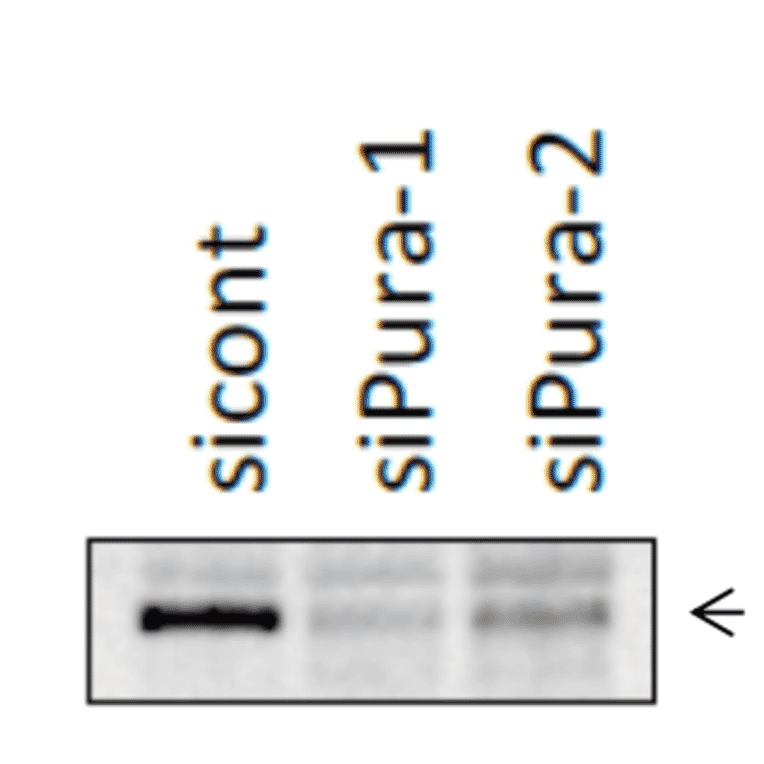 Identification of Pura protein band by western blotting, using siRNA. HCT116 cells were transfected with siPura and the cell lysates were prepared after 48 h. The Pura band was indicated by an arrow at 38 kDa position.