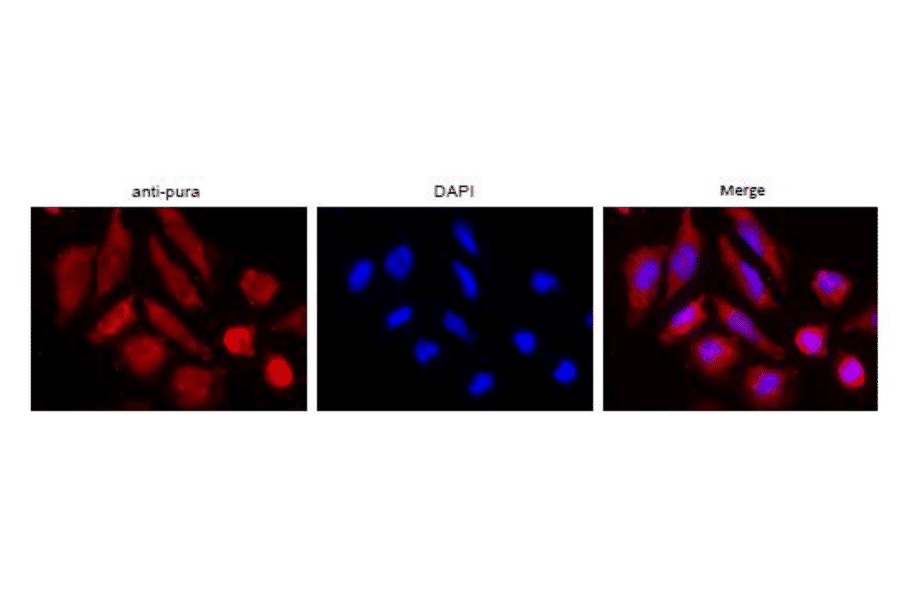 Immunofluorescence attaining of Pura protein in HeLa cells with Anti-Pura antibody. The anti-Pura antibody was used at 1/100 dilution and as the second antibody, Alexa 555-conjugated goat anti-rabbit IgG antibody was used at 1/1,000 dilution. DNA was stained with DAPI.