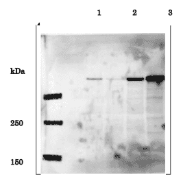 Identification of EDD in whole cell extracts of human cells by western blotting using anti-EDD antibody. Lane 1; HeLa cells transfected with control siRNA Lane 2; HeLa cells transfected with EDD-specific siRNA Lane 3; HEK293T cells transfected with pFlag-CMV-5b empty vector Lane 4; HEK293T cells transfected with pCMV-Tag2b-EDD expression vector Predicted molecular mass of EDD is 309 kDa and the corresponding band in Lane 1 is much reduced in Lane 2 by introduction of the EDD-specific siRNA. Note that expression level of EDD in HEK293T cells is much higher than in HeLa cells. The data are by courtesy of Prof. M. Fujita of Kyushu University