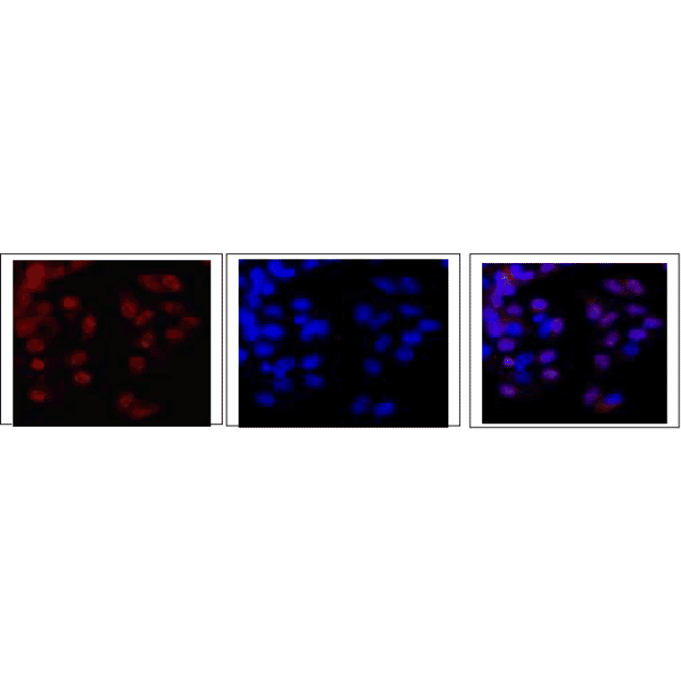 Fig.2. Immunofluorescence staining of EDD protein in MCF7 cells.