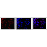 Fig.2. Immunofluorescence staining of EDD protein in MCF7 cells.