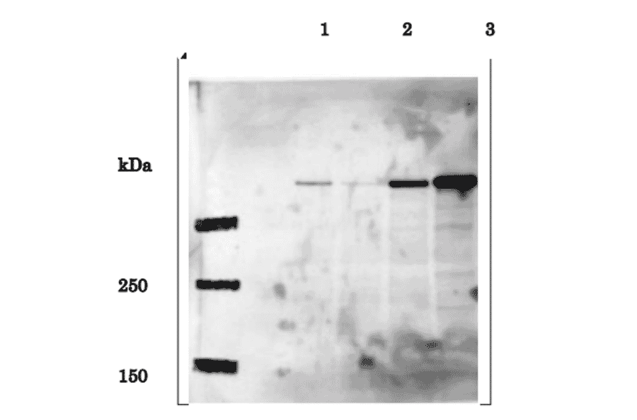 Identification of EDD in whole cell extracts of human cells by western blotting using anti-EDD antibody. Lane 1; HeLa cells transfected with control siRNA Lane 2; HeLa cells transfected with EDD-specific siRNA Lane 3; HEK293T cells transfected with pFlag-CMV-5b empty vector Lane 4; HEK293T cells transfected with pCMV-Tag2b-EDD expression vector Predicted molecular mass of EDD is 309 kDa and the corresponding band in Lane 1 is much reduced in Lane 2 by introduction of the EDD-specific siRNA. Note that expression level of EDD in HEK293T cells is much higher than in HeLa cells. The data are by courtesy of Prof. M. Fujita of Kyushu University