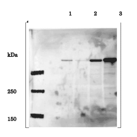 Identification of EDD in whole cell extracts of human cells by western blotting using anti-EDD antibody. Lane 1; HeLa cells transfected with control siRNA Lane 2; HeLa cells transfected with EDD-specific siRNA Lane 3; HEK293T cells transfected with pFlag-CMV-5b empty vector Lane 4; HEK293T cells transfected with pCMV-Tag2b-EDD expression vector Predicted molecular mass of EDD is 309 kDa and the corresponding band in Lane 1 is much reduced in Lane 2 by introduction of the EDD-specific siRNA. Note that expression level of EDD in HEK293T cells is much higher than in HeLa cells. The data are by courtesy of Prof. M. Fujita of Kyushu University