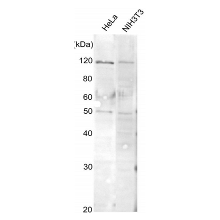 Detection of endogenous AlaRS protein in whole cell extracts by Western blotting with this antibody. HeLa and NIH3T3 lyates (10 µg). The anti-AlaRS antiserum was used at 1/300 dilution