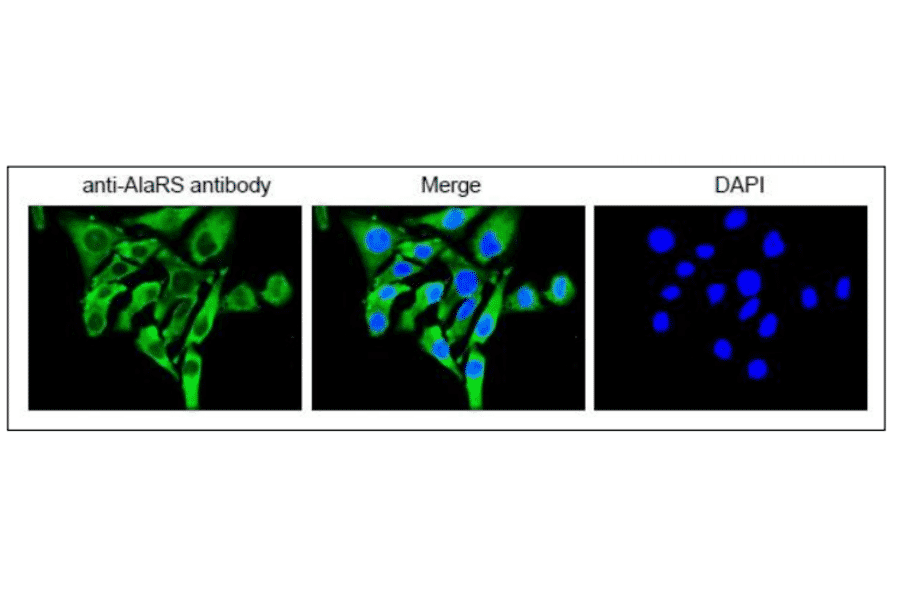 Immunofluorescence staining of AlaRS protein in HeLa cells by using anti-AlaRS antibody. The cells were fixed with 4% paraformaldehyde and permeabilized with 0.25% TritonX100. The antibody was used at 1/100 dilution. As the second antibody, Alexa Fluor 488 conjugated goat anti-rabbit IgG antibody was used at 1/1,000 dilution. Nuclear DNA was stained with DAPI (left) and the merged image was shown in the center.