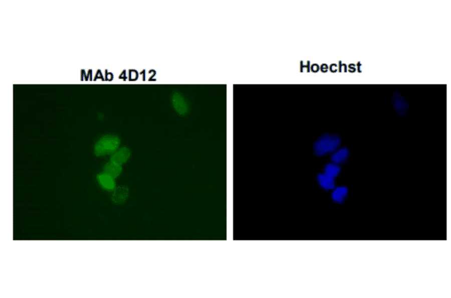 Immunofluorescence staining of SUMO-1 with the antibody 4D12 in the mouse primary culture neurons. 