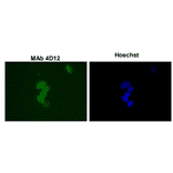 Immunofluorescence staining of SUMO-1 with the antibody 4D12 in the mouse primary culture neurons. 