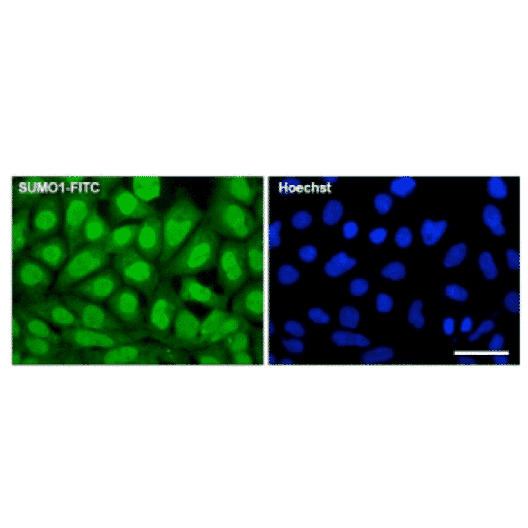 Fluorescence immunocytochemistry for endogenous SUMO1 expression. 