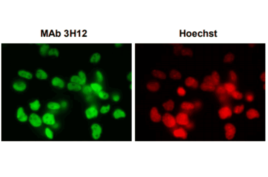 Immunofluorescence staining of SUMO-2/3 with the anti-SUMO2/3 antibody (3H12) in the mouse primary neural progenitor cells. DNA was stained with Hoechst. 