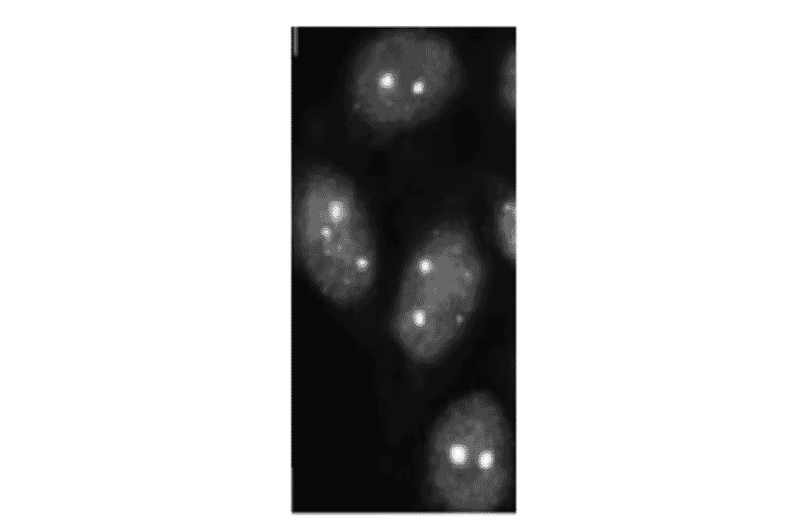 SUMO-2/3 foci detection in C-33A cells byimmunofluorescence staining with anti-SUMO-2/3 antibody (3H12). 