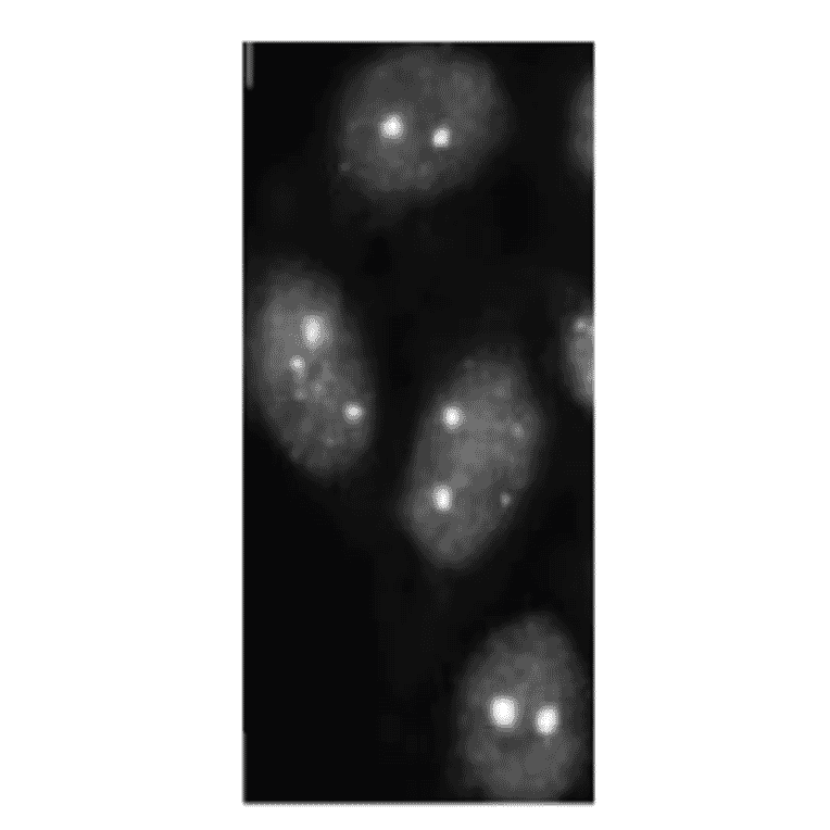 SUMO-2/3 foci detection in C-33A cells byimmunofluorescence staining with anti-SUMO-2/3 antibody (3H12). 