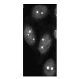 SUMO-2/3 foci detection in C-33A cells byimmunofluorescence staining with anti-SUMO-2/3 antibody (3H12). 