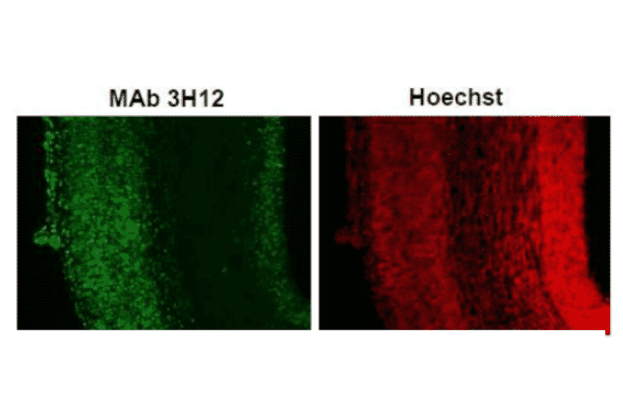 Immunohistochemistry of Coronal section of E16.mouse cerebral cortex 