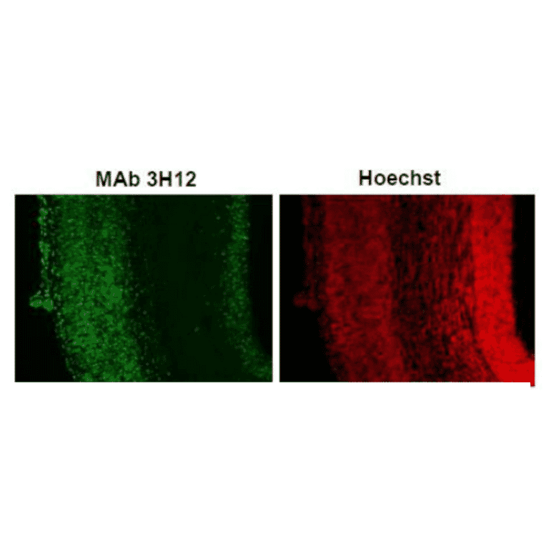Immunohistochemistry of Coronal section of E16.mouse cerebral cortex 