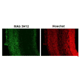 Immunohistochemistry of Coronal section of E16.mouse cerebral cortex 