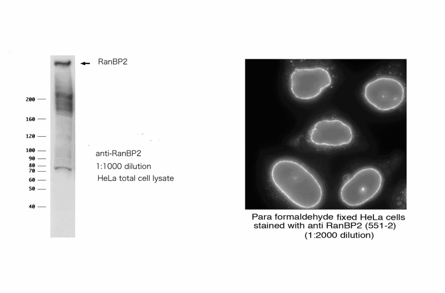 RanBP2 cDNA will be available upon request: 71-003-1 pBluescript KS(+)-RanBP2 cDNA
