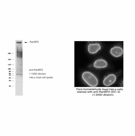 RanBP2 cDNA will be available upon request: 71-003-1 pBluescript KS(+)-RanBP2 cDNA