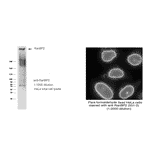 RanBP2 cDNA will be available upon request: 71-003-1 pBluescript KS(+)-RanBP2 cDNA