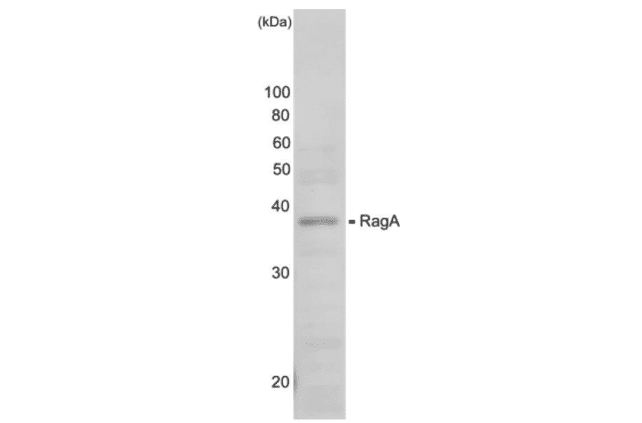 Western blot analysis of RagA protein in the whole cell extracts (HeLa cell g). Anti-RagA antiserum was used at 1,000 dilution.