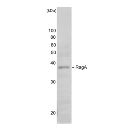 Western blot analysis of RagA protein in the whole cell extracts (HeLa cell g). Anti-RagA antiserum was used at 1,000 dilution.